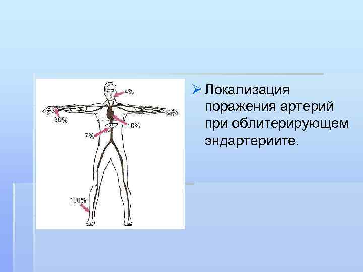 Локализация поражения. Окклюзионные поражения артерий. Локализация артерий в организме. Термин локализация артерии.