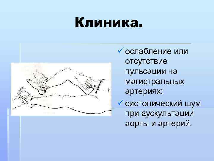 Окклюзионная артерия