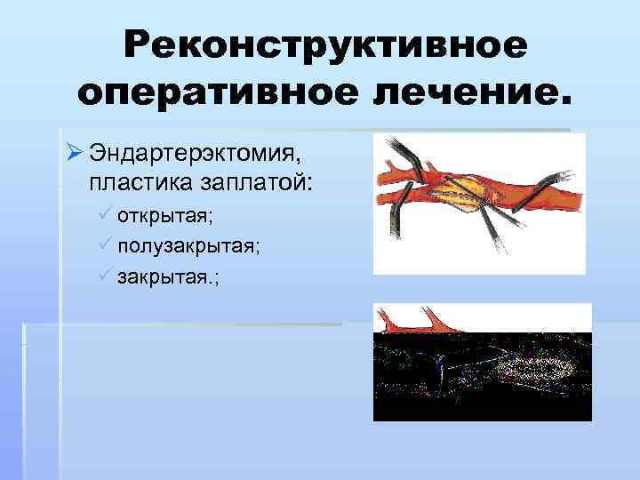 Реконструктивное оперативное лечение. Ø Эндартерэктомия, пластика заплатой: ü открытая; ü полузакрытая; ü закрытая. ;