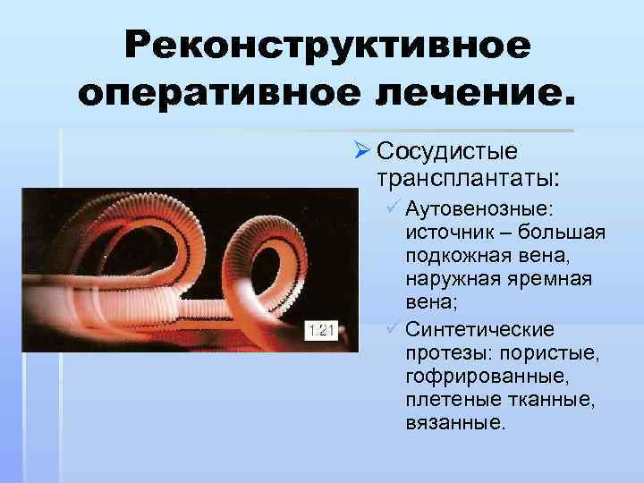 Реконструктивное оперативное лечение. Ø Сосудистые трансплантаты: ü Аутовенозные: источник – большая подкожная вена, наружная