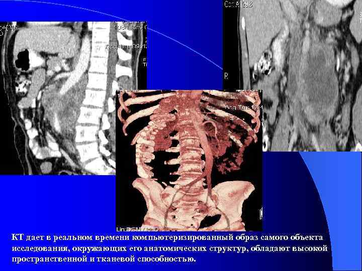 КТ дает в реальном времени компьютеризированный образ самого объекта исследования, окружающих его анатомических структур,