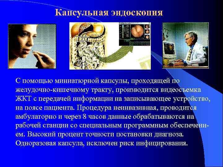 Капсульная эндоскопия С помощью миниатюрной капсулы, проходящей по желудочно-кишечному тракту, производится видеосъемка ЖКТ с