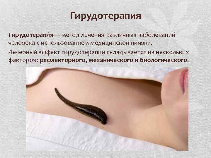 Гирудотерапия Гирудотерапи я— метод лечения различных заболеваний человека с использованием медицинской пиявки. Лечебный эффект
