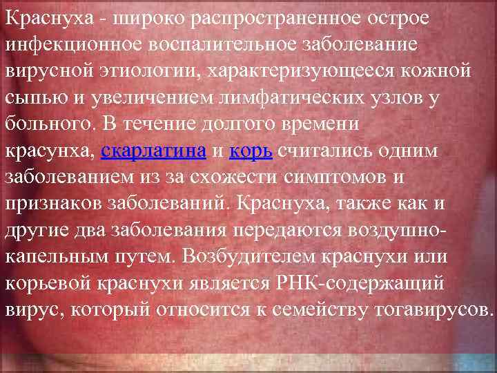 Краснуха - широко распространенное острое инфекционное воспалительное заболевание вирусной этиологии, характеризующееся кожной сыпью и