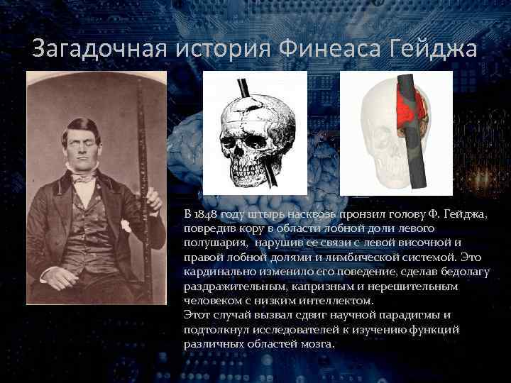 Загадочная история Финеаса Гейджа В 1848 году штырь насквозь пронзил голову Ф. Гейджа, повредив