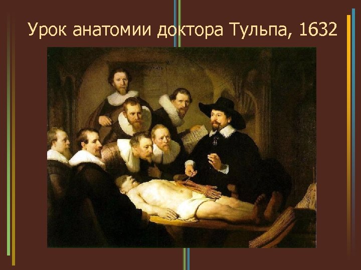 Урок анатомии доктора Тульпа, 1632 