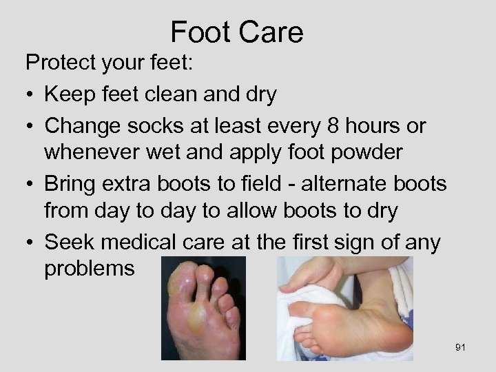Foot Care Protect your feet: • Keep feet clean and dry • Change socks