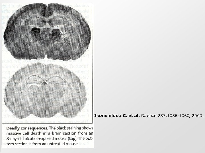 Ikonomidou C, et al. Science 287: 1056 -1060, 2000. 