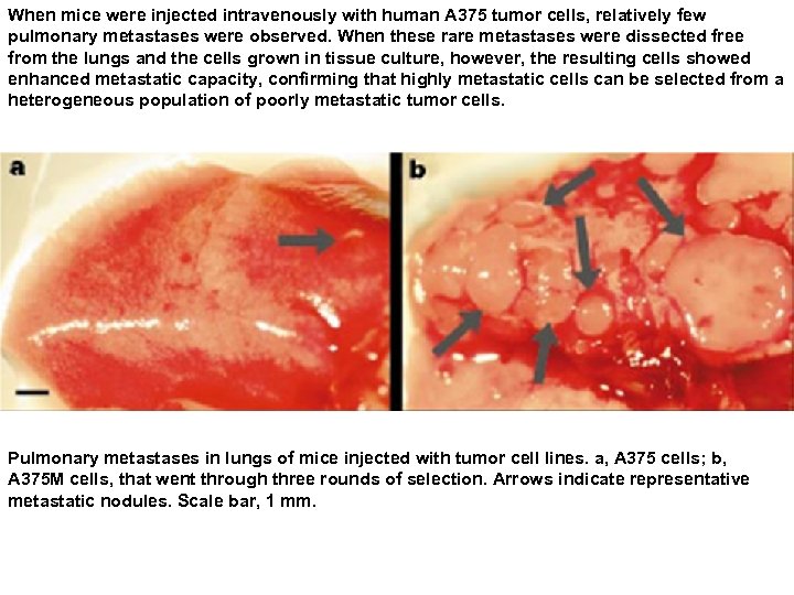 When mice were injected intravenously with human A 375 tumor cells, relatively few pulmonary