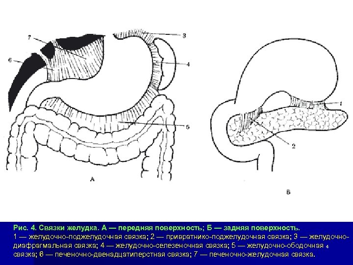 Рис. 4. Связки желудка. А — передняя поверхность; Б — задняя поверхность. 1 —