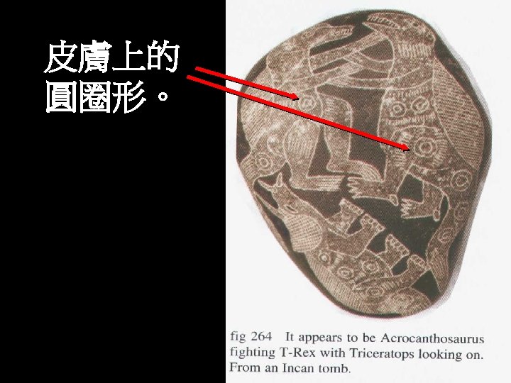 皮膚上的 圓圈形。 