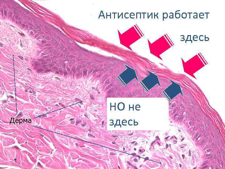 Антисептик работает здесь Дерма НО не здесь SG 31 