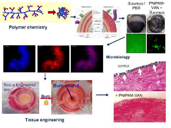 S. aureus / PBS Polymer chemistry Microbiology control Tissue Engineered skin Burn wound Burn