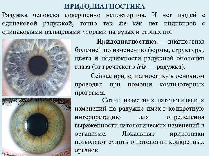 ИРИДОДИАГНОСТИКА Радужка человека совершенно неповторима. И нет людей с одинаковой радужкой, точно так же