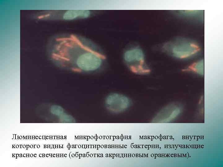 Люминесцентная микрофотография макрофага, внутри которого видны фагоцитированные бактерии, излучающие красное свечение (обработка акридиновым оранжевым).