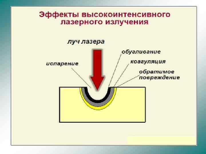 На рисунке представлены эффекты высокоинтенсивного лазерного излучения на биологические ткани где