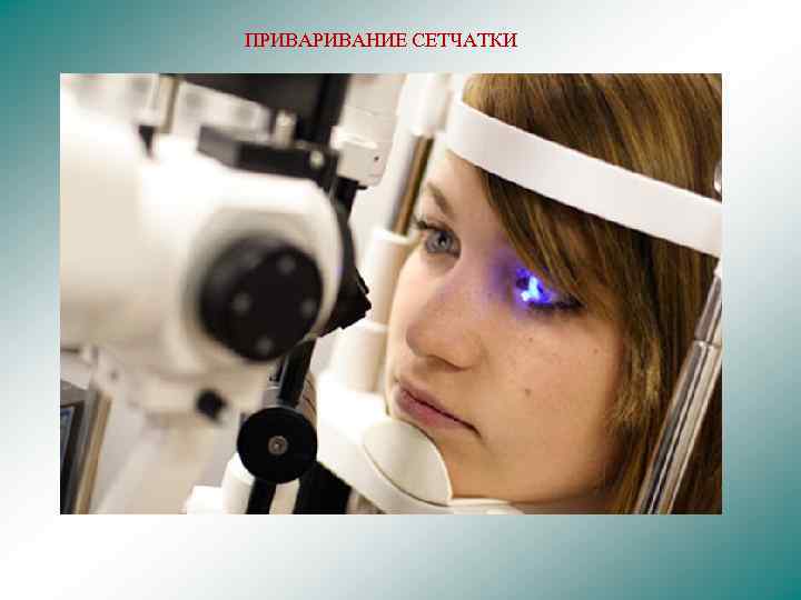 ПРИВАНИЕ СЕТЧАТКИ 