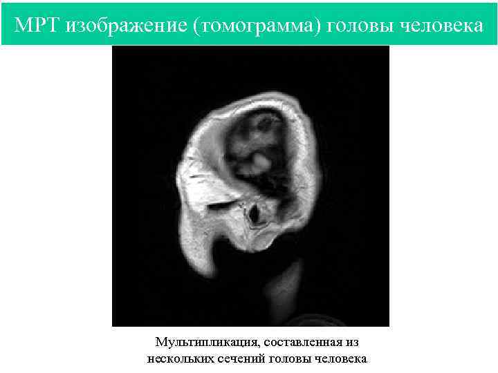 МРТ изображение (томограмма) головы человека Мультипликация, составленная из нескольких сечений головы человека 