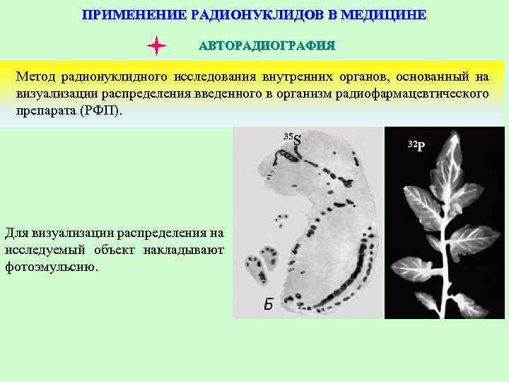 ПРИМЕНЕНИЕ РАДИОНУКЛИДОВ В МЕДИЦИНЕ АВТОРАДИОГРАФИЯ Метод радионуклидного исследования внутренних органов, основанный на визуализации распределения