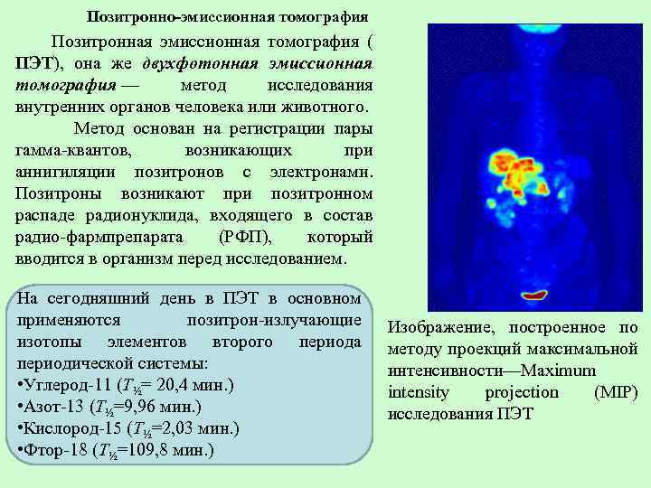 Позитронно-эмиссионная томография Позитронная эмиссионная томография ( ПЭТ), она же двухфотонная эмиссионная томография — метод