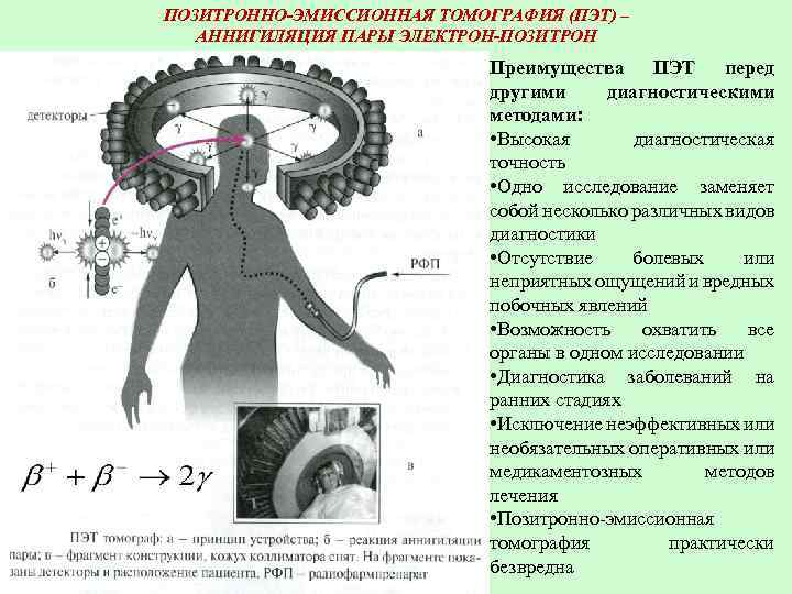 ПОЗИТРОННО-ЭМИССИОННАЯ ТОМОГРАФИЯ (ПЭТ) – АННИГИЛЯЦИЯ ПАРЫ ЭЛЕКТРОН-ПОЗИТРОН Преимущества ПЭТ перед другими диагностическими методами: •