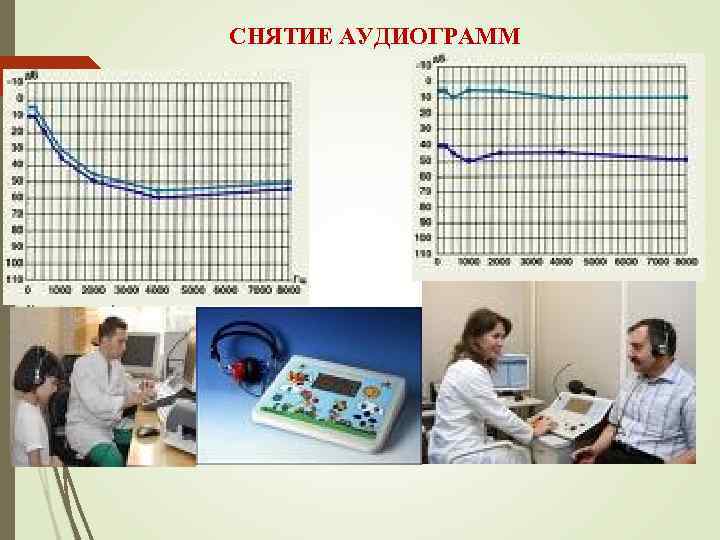 СНЯТИЕ АУДИОГРАММ 