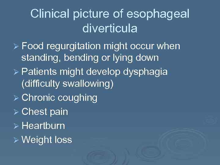Clinical picture of esophageal diverticula Ø Food regurgitation might occur when standing, bending or