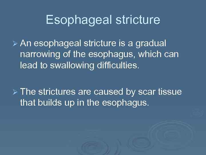 Esophageal stricture Ø An esophageal stricture is a gradual narrowing of the esophagus, which