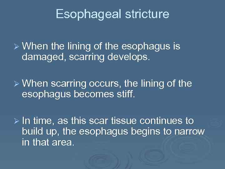 Esophageal stricture Ø When the lining of the esophagus is damaged, scarring develops. Ø