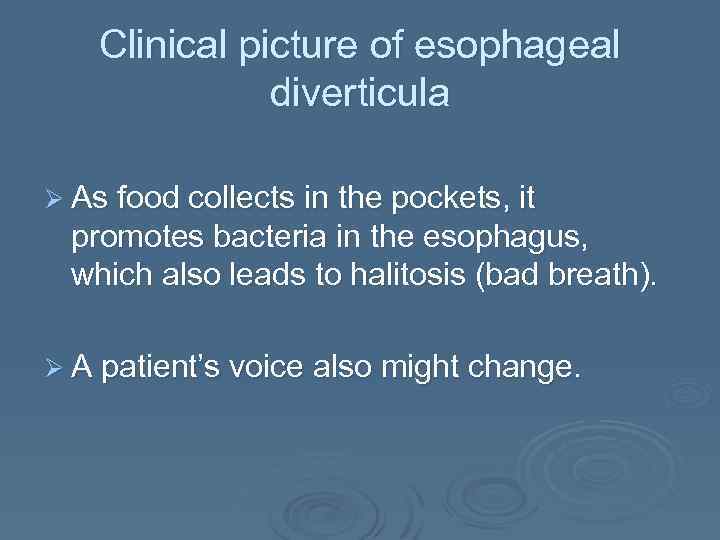 Clinical picture of esophageal diverticula Ø As food collects in the pockets, it promotes