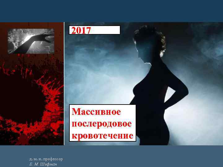 2017 Массивное послеродовое кровотечение д. м. н. профессор Е. М. Шифман 