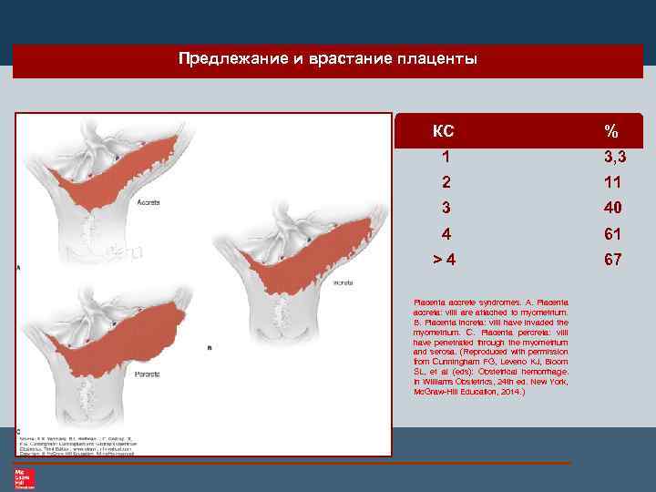 Предлежание и врастание плаценты КС % 1 3, 3 2 11 3 40 4