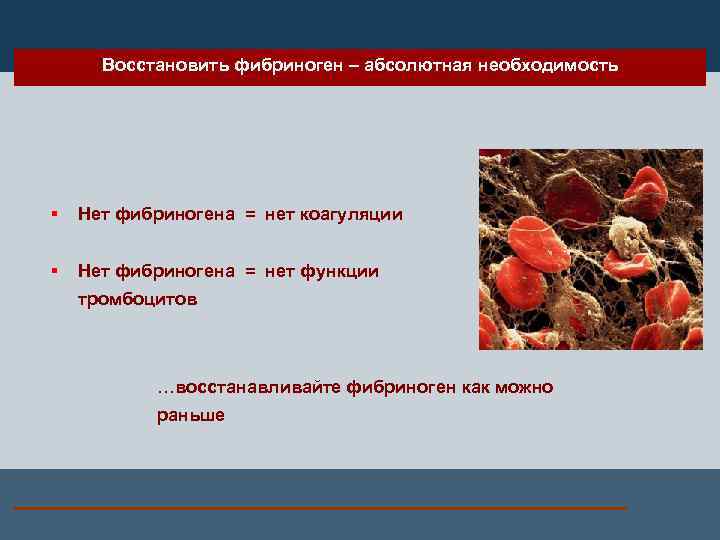Восстановить фибриноген – абсолютная необходимость § Нет фибриногена = нет коагуляции § Нет фибриногена