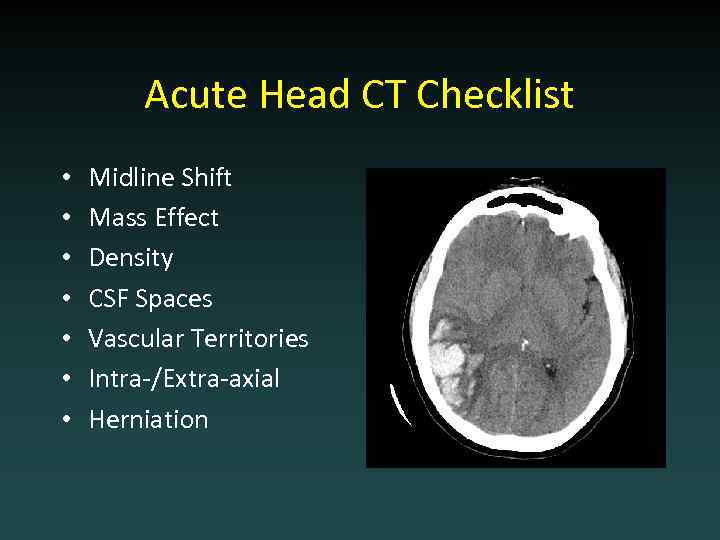 Acute Head CT Checklist • • Midline Shift Mass Effect Density CSF Spaces Vascular