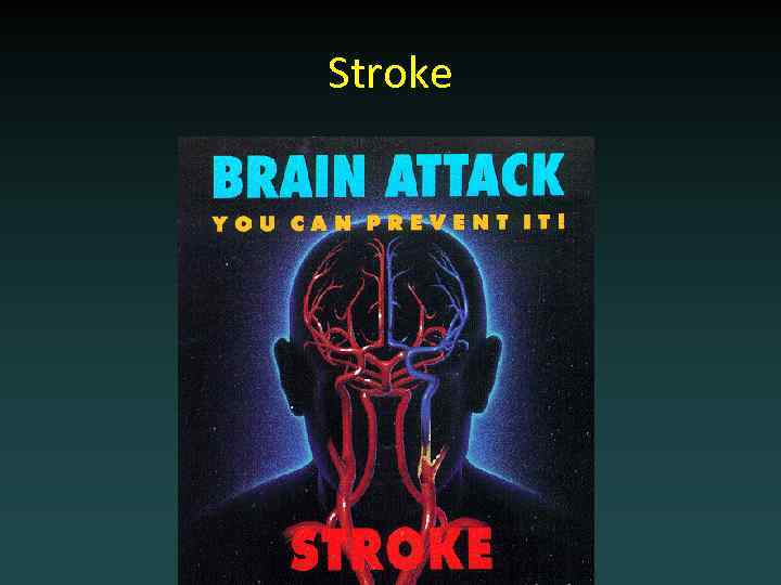 Stroke 