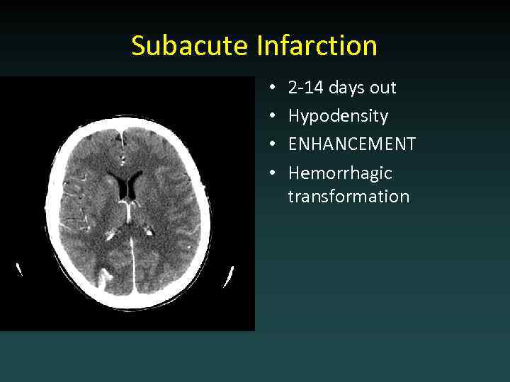Subacute Infarction • • 2 -14 days out Hypodensity ENHANCEMENT Hemorrhagic transformation 