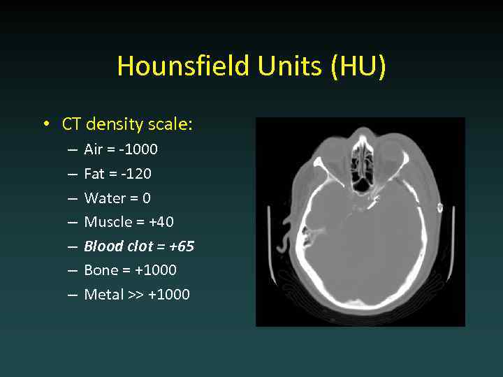 Hounsfield Units (HU) • CT density scale: – – – – Air = -1000