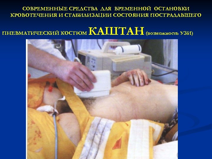 СОВРЕМЕННЫЕ СРЕДСТВА ДЛЯ ВРЕМЕННОЙ ОСТАНОВКИ КРОВОТЕЧЕНИЯ И СТАБИЛИЗАЦИИ СОСТОЯНИЯ ПОСТРАДАВШЕГО ПНЕВМАТИЧЕСКИЙ КОСТЮМ КАШТАН (возможность