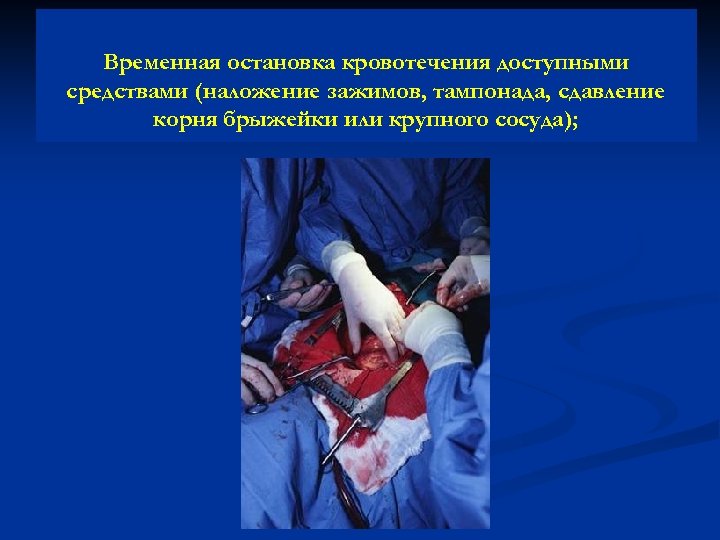 Временная остановка кровотечения доступными средствами (наложение зажимов, тампонада, сдавление корня брыжейки или крупного сосуда);