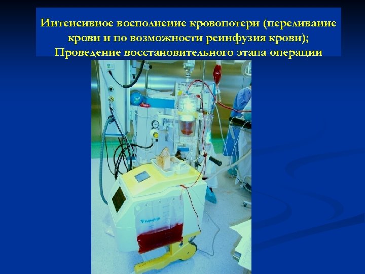Интенсивное восполнение кровопотери (переливание крови и по возможности реинфузия крови); Проведение восстановительного этапа операции