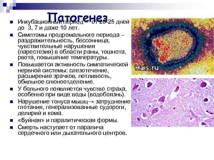 n n n n Патогенез Инкубационный период – от 20 -25 дней до 3,