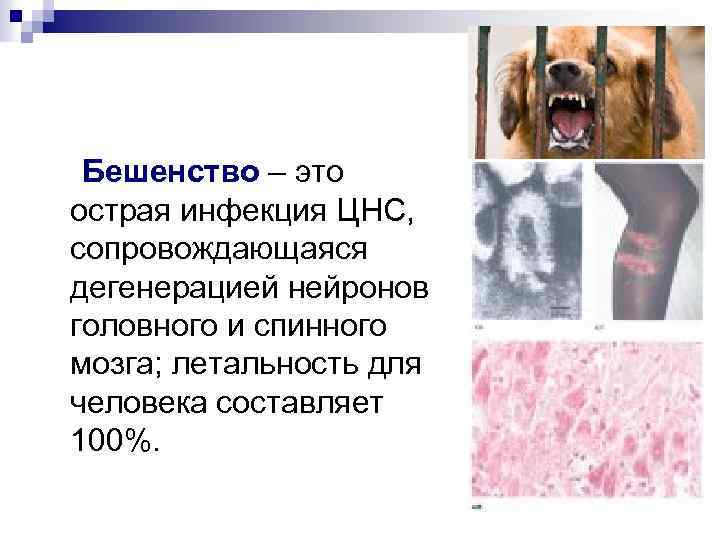 Бешенство – это острая инфекция ЦНС, сопровождающаяся дегенерацией нейронов головного и спинного мозга; летальность