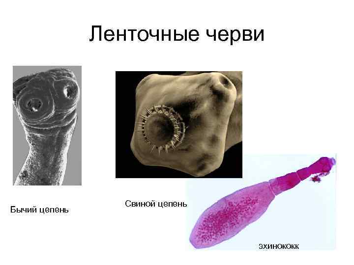 Ленточные черви Бычий цепень Свиной цепень эхинококк 