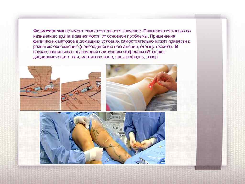Физиотерапия не имеет самостоятельного значение. Применяется только по назначению врача в зависимости от основной