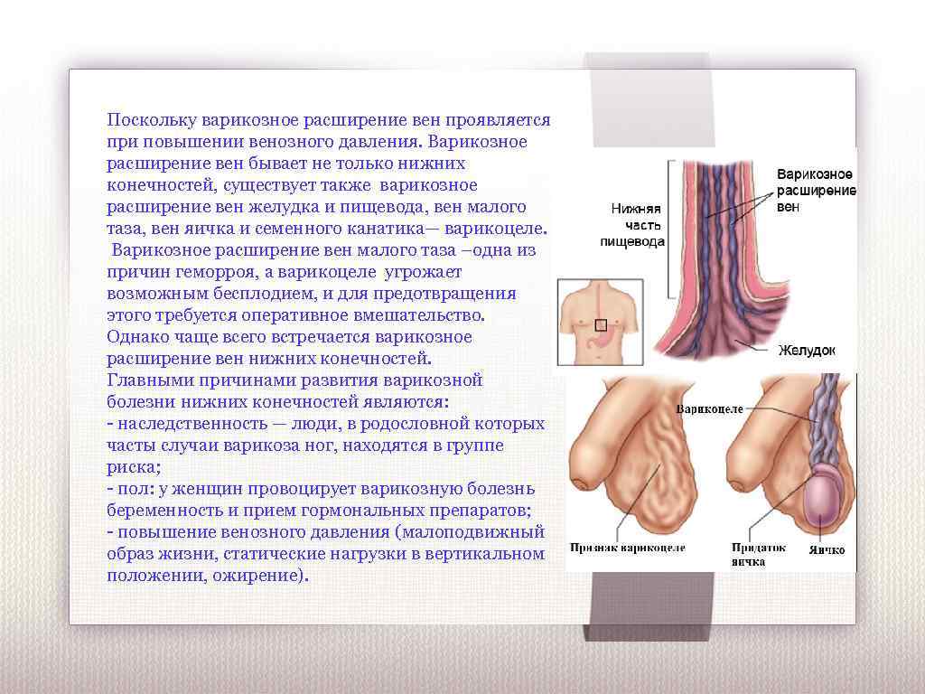 Поскольку варикозное расширение вен проявляется при повышении венозного давления. Варикозное расширение вен бывает не