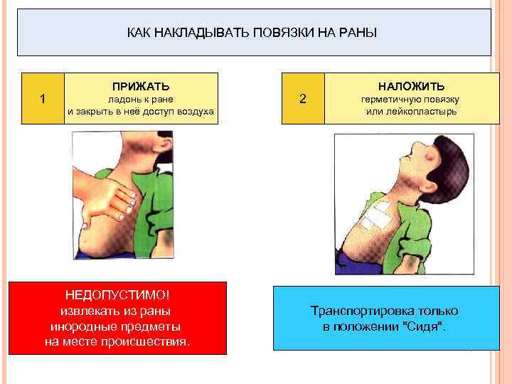 КАК НАКЛАДЫВАТЬ ПОВЯЗКИ НА РАНЫ 1 ПРИЖАТЬ ладонь к ране и закрыть в неё