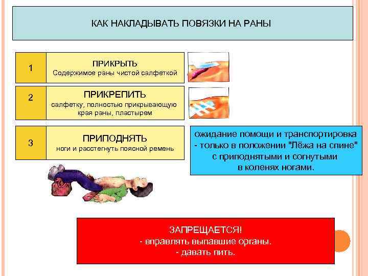 КАК НАКЛАДЫВАТЬ ПОВЯЗКИ НА РАНЫ 1 2 3 ПРИКРЫТЬ Содержимое раны чистой салфеткой ПРИКРЕПИТЬ