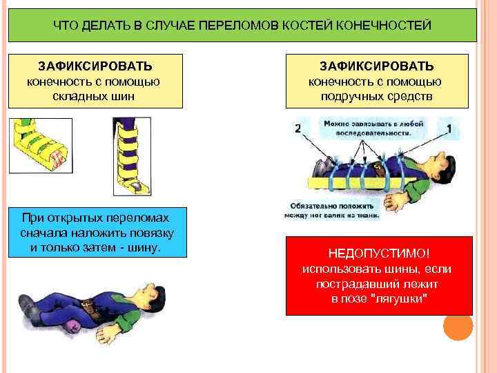 ЧТО ДЕЛАТЬ В СЛУЧАЕ ПЕРЕЛОМОВ КОСТЕЙ КОНЕЧНОСТЕЙ ЗАФИКСИРОВАТЬ конечность с помощью складных шин При