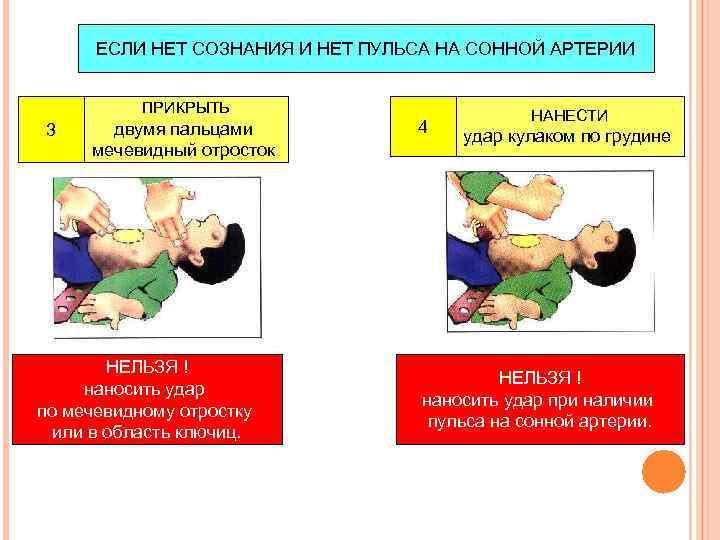 В случае отсутствия пульса на сонной артерии