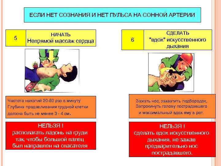 ЕСЛИ НЕТ СОЗНАНИЯ И НЕТ ПУЛЬСА НА СОННОЙ АРТЕРИИ 5 НАЧАТЬ Непрямой массаж сердца